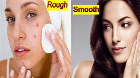 rough facials|How to Smooth Out Rough Skin on Your Face .